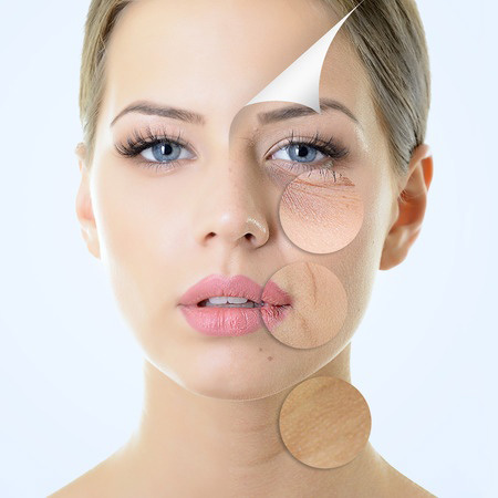womans face showing the effects of hyaluronic acid
