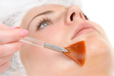 A client having cosmetic skin peels treatments
