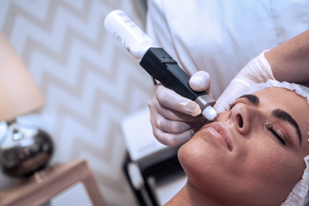 Microdermabrasion Facials, all you need to know before you book