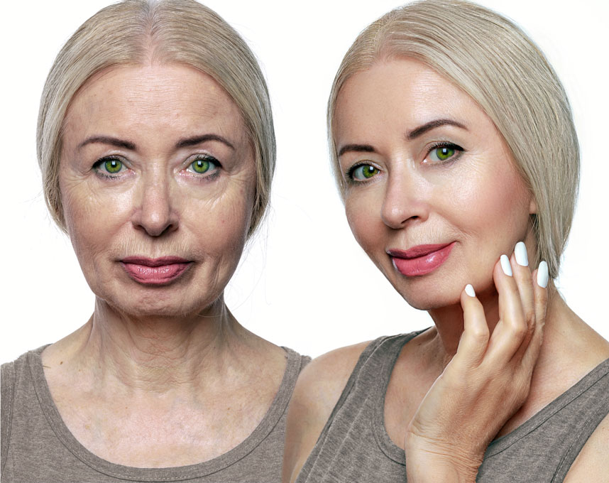 Woman with Youthful Skin after treatment